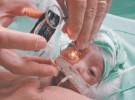 Reducen ceguera en bebés prematuros, con red de telemedicina