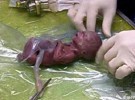 El bebé más prematuro sobrevive con sólo 275 gramos de peso