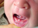 Hay bebés que ya tienen dientes al nacer