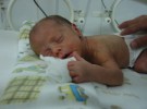 Más riesgo de autismo en bebés prematuros