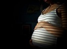 Padecer síndrome de ovario poliquístico puede causar complicaciones en el embarazo