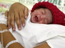 Exámenes auditivos, menor fiabilidad en niños nacidos por cesárea