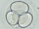 El Tribunal de Estrasburgo multa a Italia por no permitir la elección de embriones sanos en tratamientos de fertilidad