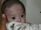 Malformaciones congénitas, alto índice en los bebés chinos