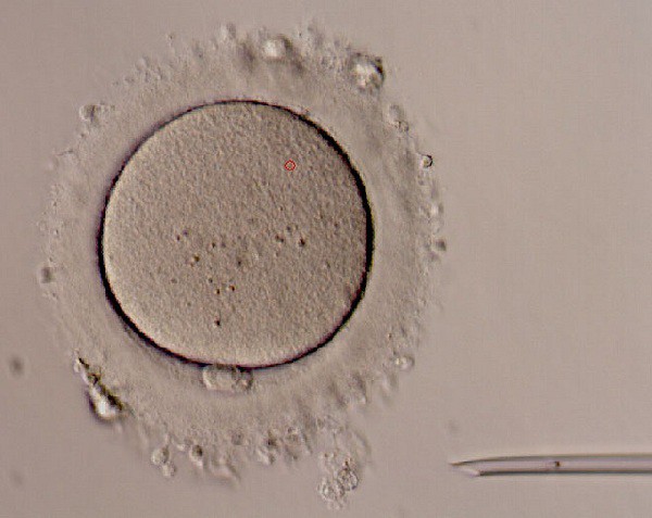 Nuevos pasos para mantener la fertilidad: Estudio de dos proteínas causantes de la muerte de óvulos