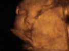 Se confirma que los fetos pueden bostezar
