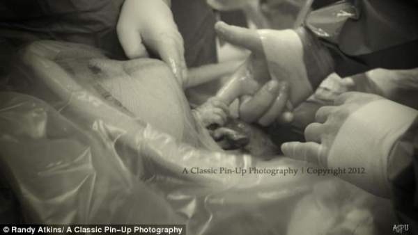 Imágenes que llegan al corazón: Un bebé agarra el dedo del doctor antes de nacer