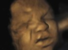 Estudian las expresiones faciales de los bebés en el vientre materno