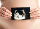 La ecografía en el embarazo, totalmente segura para el bebé