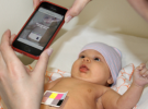 Una aplicación de móvil para detectar la ictericia en los bebés
