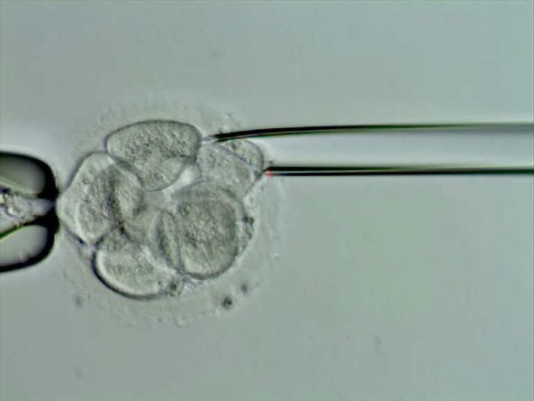 La selección de embriones logra el primer embarazo de una pareja con Rh distinto