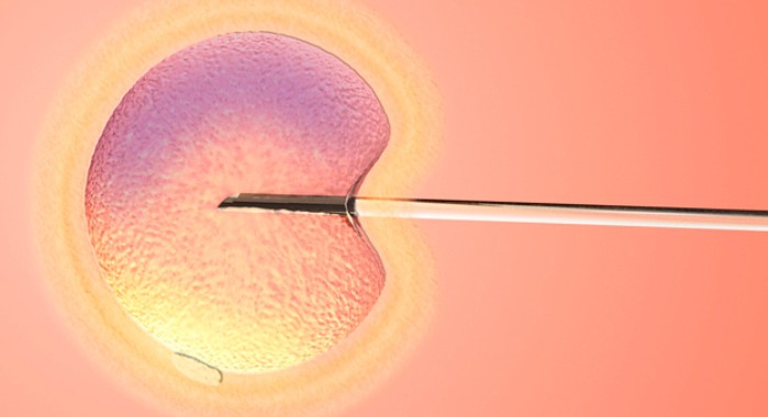 Reproducción asistida: Microinyección espermática