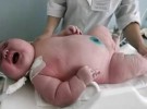 Nace en Australia un bebé de 18 kilos