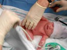 Un 2 por ciento de los recién nacidos padecen alguna enfermedad genética