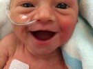 La sonrisa de una bebé prematura que ha sorprendido al mundo