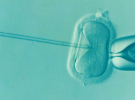 ¿Influye la fimosis en la fertilidad?
