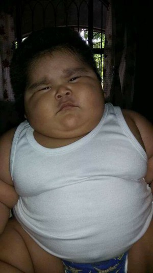 el bebé más obeso del mundo