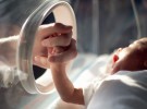 Menor flujo sanguíneo cerebral en los bebés prematuros